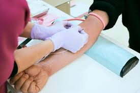 تحليل D dimer