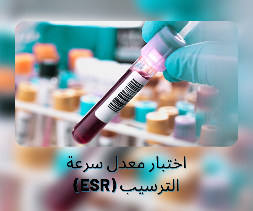 معدل سرعة الترسيب